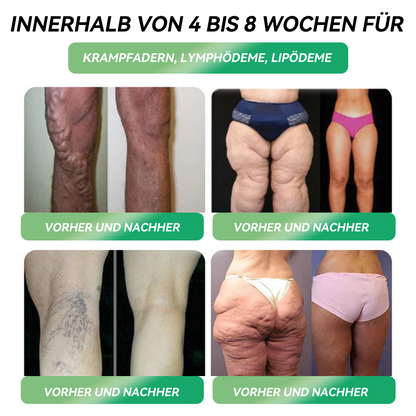 Nur noch 10 Boxen verfügbar! ⏰ Sichern Sie sich jetzt 30% Rabatt! Endokrinologen empfehlen 4–6 Boxen, um den Gewichtsverlust zu stabilisieren und einen Jo-Jo-Effekt zu verhindern. Letzte Chance vor Jahresende!